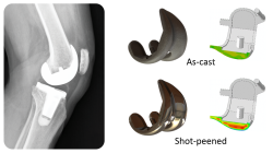 Residual stress measurement results in medical prosthetic knee replacement implant.